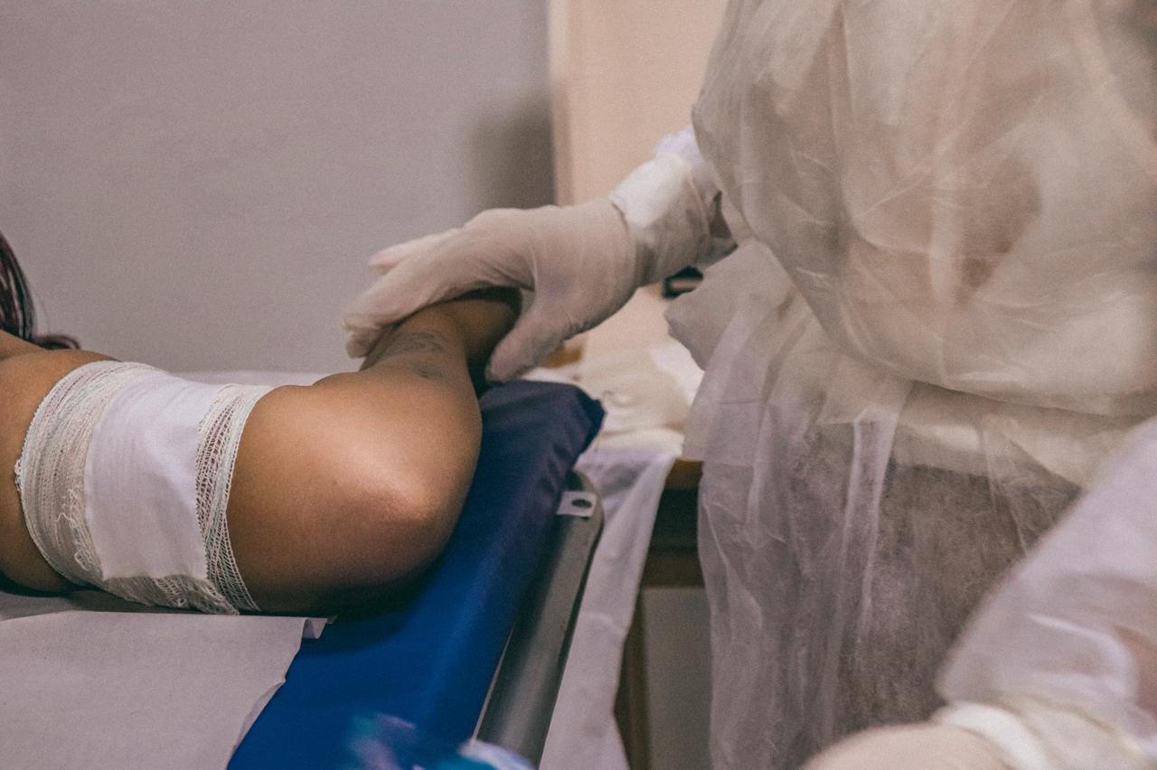 Foto de inserção de Implanon