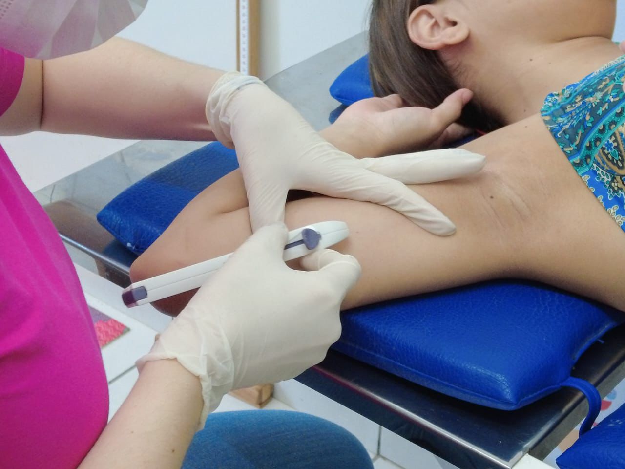 Foto de inserção do Implanon