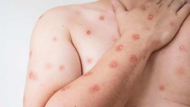 Notícias 8 b142893b 2a12 44ee 8591 ab3fa10684c3 e1771857427247