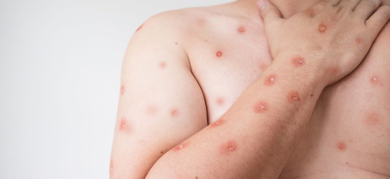 b142893b 2a12 44ee 8591 ab3fa10684c3